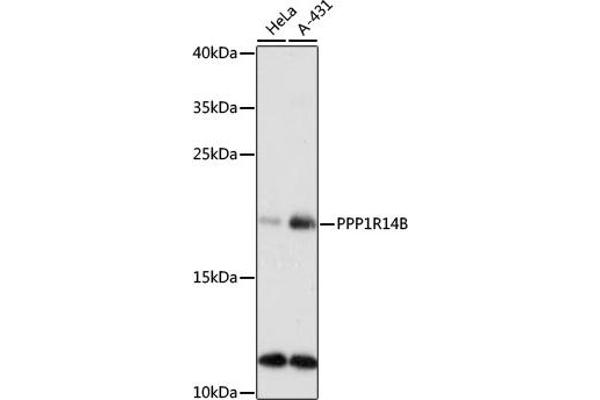 PPP1R14B Antikörper  (AA 68-147)
