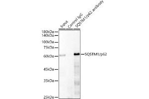 Immunoprecipitation analysis of 300 μg extracts of 293T cells using 3 μg SQSTM1/p62 antibody (ABIN7270205). (SQSTM1 antibody)