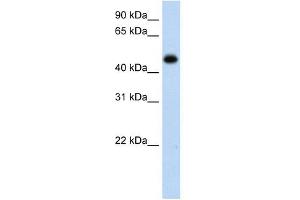 HAO1 antibody used at 1 ug/ml to detect target protein. (HAO1 antibody)