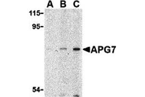 Western Blotting (WB) image for anti-ATG7 Autophagy Related 7 (ATG7) (N-Term) antibody (ABIN1031233) (ATG7 antibody  (N-Term))