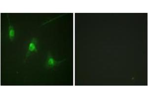 Immunofluorescence analysis of NIH-3T3 cells, using MSK1 (Phospho-Ser360) Antibody. (MSK1 antibody  (pSer360))