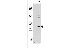 Western blot analysis of NNMT using rabbit polyclonal NNMT Antibody using 293 cell lysates (2 ug/lane) either nontransfected (Lane 1) or transiently transfected with the NNMT gene (Lane 2). (NNMT antibody  (AA 77-106))