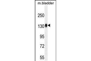 Western blot analysis in mouse bladder tissue lysates (35ug/lane). (TDRD7 antibody  (C-Term))