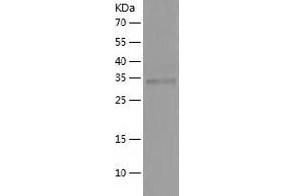 UPP1 Protein (AA 1-310) (His tag)