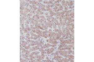 Immunohistochemical analysis of C on paraffin-embedded Human liver tissue. (UGT2B15 antibody  (AA 156-185))