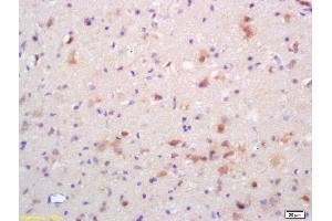 Formalin-fixed and paraffin embedded rat brain labeled with Rabbit Anti Phospho-NMDAR2B (Tyr1336) Polyclonal Antibody, Unconjugated (ABIN801228) at 1:200 followed by conjugation to the secondary antibody and DAB staining (GRIN2B antibody  (pTyr1336))