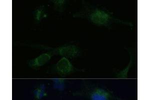 Immunofluorescence analysis of U-251 MG cells using VHL Polyclonal Antibody at dilution of 1:100 (40x lens). (VHL antibody)