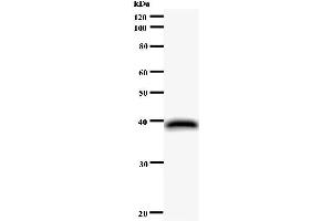 Western Blotting (WB) image for anti-Nuclear Fragile X Mental Retardation Protein Interacting Protein 1 (NUFIP1) antibody (ABIN931157)
