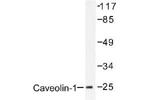 Image no. 1 for anti-Caveolin 1, Caveolae Protein, 22kDa (CAV1) antibody (ABIN265339) (Caveolin-1 antibody)