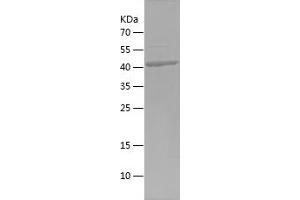 Western Blotting (WB) image for Nuclear RNA Export Factor 1 (NXF1) (AA 426-619) protein (His-IF2DI Tag) (ABIN7282492) (NXF1 Protein (AA 426-619) (His-IF2DI Tag))
