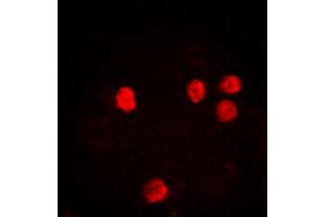 Immunofluorescent analysis of Histone H2B (AcK12) staining in HeLa cells. (Histone H2B antibody  (acLys12, N-Term))