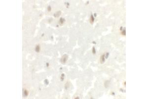Immunohistochemistry (IHC) image for anti-LIM Homeobox Transcription Factor 1, alpha (LMX1A) (C-Term) antibody (ABIN1077395) (LMX1A antibody  (C-Term))