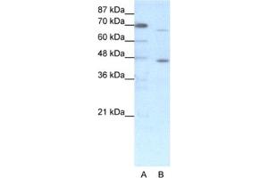 Western Blotting (WB) image for anti-Estrogen Receptor 2 (ESR2) antibody (ABIN2460264) (ESR2 antibody)