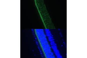 Immunofluorescence analysis of rat eye using GNGT1 Polyclonal Antibody (ABIN7267288) at dilution of 1:100 (40x lens). (GNGT1 antibody  (AA 1-45))