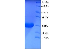 SDS-PAGE (SDS) image for Interleukin 1 alpha (IL1A) (AA 113-271) protein (His tag) (ABIN5713552)
