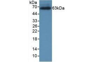 Detection of Recombinant CRHBP, Rat using Monoclonal Antibody to Corticotropin Releasing Hormone Binding Protein (CRHBP) (CRHBP antibody  (AA 25-322))