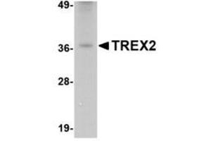Image no. 1 for anti-three Prime Repair Exonuclease 2 (Trex2) (C-Term) antibody (ABIN341719) (TREX2 antibody  (C-Term))