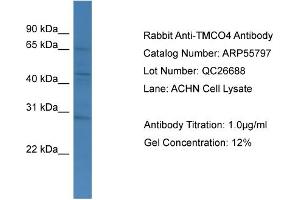 WB Suggested Anti-TMCO4  Antibody Titration: 0. (TMCO4 antibody  (C-Term))