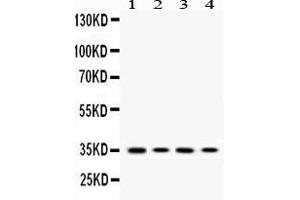 Western blot analysis of MC1 Receptor expression in PC12 whole cell lysates ( Lane 1), HEPA1-6 whole cell lysates ( Lane 2), HELA whole cell lysates ( Lane 3) and A375 whole cell lysates ( Lane 4).