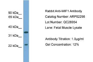 WB Suggested Anti-WIF1  Antibody Titration: 0. (WIF1 antibody  (N-Term))
