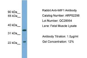 WB Suggested Anti-WIF1  Antibody Titration: 0.