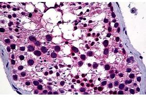 Human Testis: Formalin-Fixed, Paraffin-Embedded (FFPE) (HDAC6 antibody  (AA 7-56))