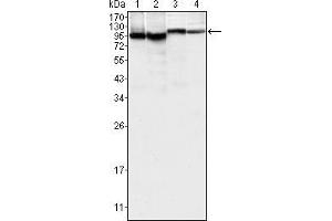 Western blot analysis using BTK mouse mAb against K562 (1), MCF-7 (2), Jurkat (3) and HEK293 (4) cell lysate. (BTK antibody)