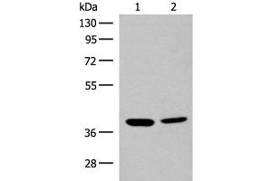 Western blot analysis of K562 and HEPG2 cell lysates using MRM1 Polyclonal Antibody at dilution of 1:400 (MRM1 antibody)