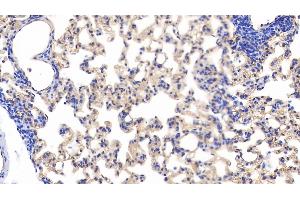 Detection of PODXL in Rat Lung Tissue using Polyclonal Antibody to Podocalyxin (PODXL) (PODXL antibody  (AA 408-485))