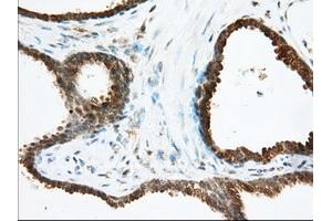 Immunohistochemical staining of paraffin-embedded Human Kidney tissue using anti-ACAT2 mouse monoclonal antibody. (ACAT2 antibody)