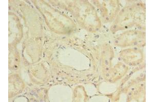 Immunohistochemistry of paraffin-embedded human kidney tissue using ABIN7150796 at dilution of 1:100 (DYRK4 antibody  (AA 201-520))
