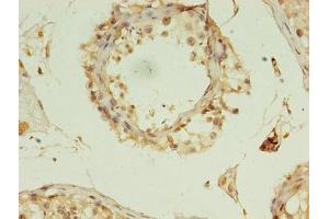 Immunohistochemistry of paraffin-embedded human testis tissue using ABIN7150974 at dilution of 1:100 (RANBP2 antibody  (AA 2601-2802))