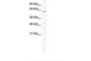 Image no. 1 for anti-Homeobox and Leucine Zipper Encoding (HOMEZ) (AA 141-190) antibody (ABIN202703) (HOMEZ antibody  (AA 141-190))