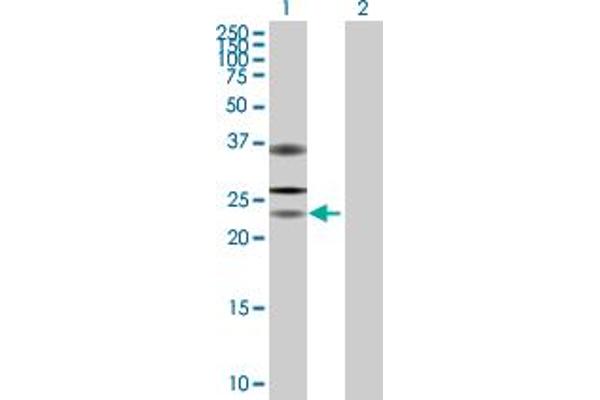 USP53 anticorps  (AA 1-188)