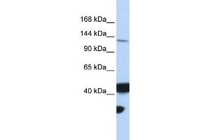 WB Suggested Anti-MLH3 Antibody Titration:  0.