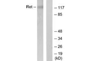 Western blot analysis of extracts from K562 cells, using Ret (Ab-1062) Antibody.