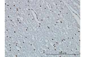 Immunoperoxidase of monoclonal antibody to HIST1H3D on formalin-fixed paraffin-embedded human lateral ventricle wall. (HIST1H3D antibody  (AA 1-60))