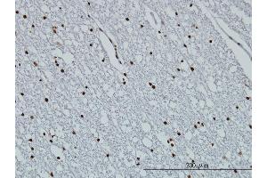 Immunoperoxidase of monoclonal antibody to HIST1H3D on formalin-fixed paraffin-embedded human lateral ventricle wall. (HIST1H3D antibody  (AA 1-60))