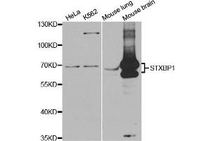 Western Blotting (WB) image for anti-Syntaxin Binding Protein 1 (STXBP1) antibody (ABIN1876608) (STXBP1 antibody)