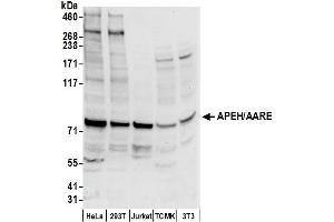 Western Blotting (WB) image for anti-N-Acylaminoacyl-Peptide Hydrolase (APEH) (AA 150-200) antibody (ABIN7453033)