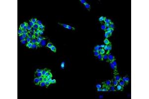 IF analysis of MC4R using anti-MC4R antibody (ABIN7602763).