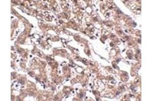 Immunohistochemistry (IHC) image for anti-Metastasis Associated in Colon Cancer 1 (MACC1) (Middle Region) antibody (ABIN1030992) (MACC1 antibody  (Middle Region))