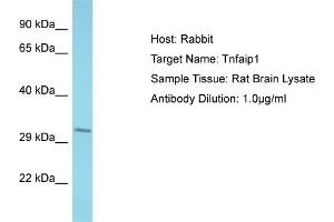 Host: Rabbit Target Name: Tnfaip1 Sample Type: Rat Brain lysates Antibody Dilution: 1. (TNFAIP1 antibody  (C-Term))