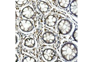 Immunohistochemistry of paraffin-embedded human colon using Tec Rabbit pAb (ABIN6128353, ABIN6148988, ABIN6148989 and ABIN6213654) at dilution of 1:100 (40x lens). (NR4A3 antibody  (AA 1-280))