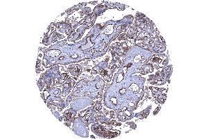 Placenta mature Strong CD141 staining of the surface cell layer of the cytotrophoblast and of endothelial cells CD141 immunohistochemistry.