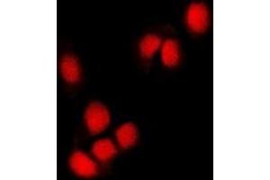 Immunofluorescent analysis of RING1b staining in U2OS cells. (RNF2 antibody)