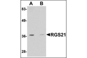 Western blot analysis: AP30716PU-N RGS21 antibody staining of HepG2 cell lysate at 0. (RGS21 antibody  (Center))