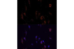 Immunofluorescence analysis of PC12 cells using OCLN antibody.