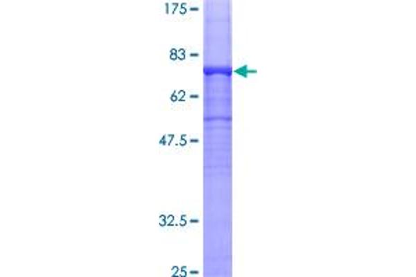 TUBA1B Protein (AA 1-451) (GST tag)