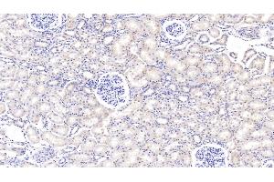 Detection of PIGR in Bovine Kidney Tissue using Polyclonal Antibody to Polymeric Immunoglobulin Receptor (PIGR) (PIGR antibody  (AA 461-560))